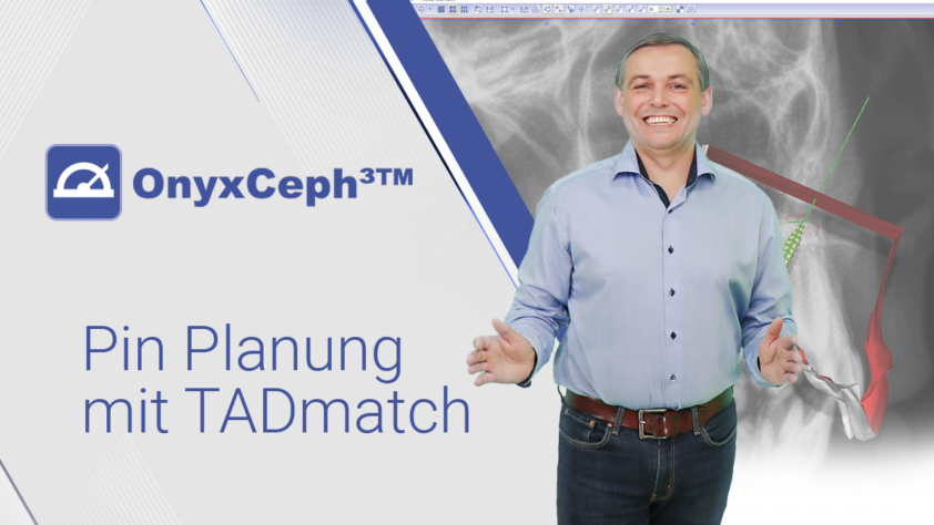 OnyxCeph³™ – Pin Planung mit TADmatch