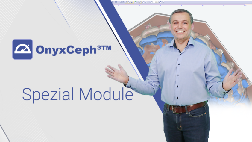 OnyxCeph³™ 17 – Spezial Module – Verfügbar: Q2