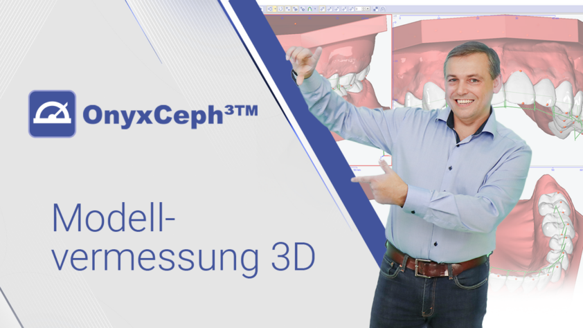 OnyxCeph³™ – Modellvermessung 3D